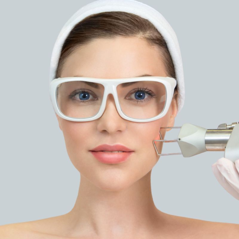 Laser CO2 Fracionado