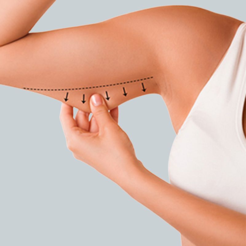 Lifting Crural e Braquial